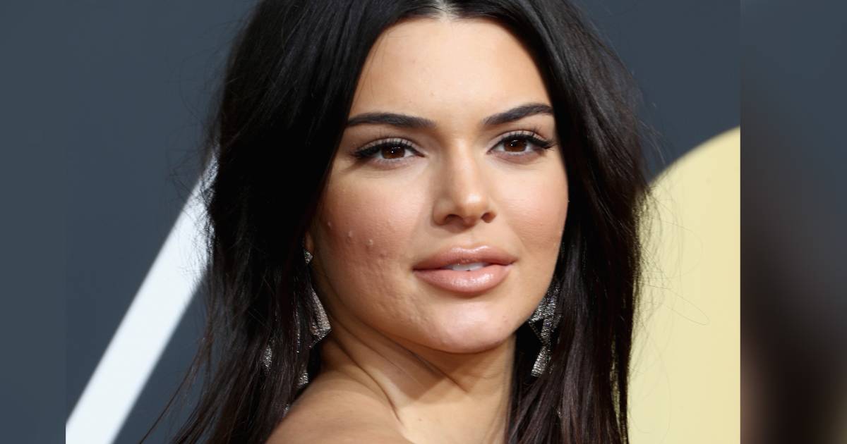 Kendall Jenner Addresses Golden Globes Acne Amp 39 Never Let That Sh T Stop You Amp 39 Kendall Jenner Addresses Golden Globes Acne Amp 39 Never Let That Sh T Stop You Amp 39